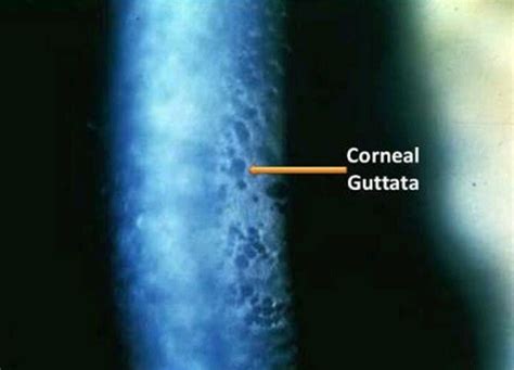 fuchs&schmitt|guttata vs fuchs.